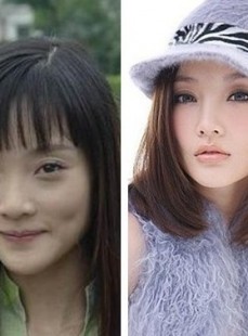 杨幂方脸回归，是岁月还是医美后遗症？