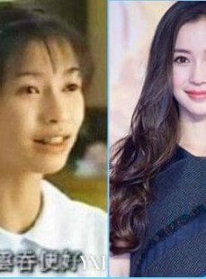 嫩模变脸杨颖：被整容史困住的盛世美颜还能撑多久？