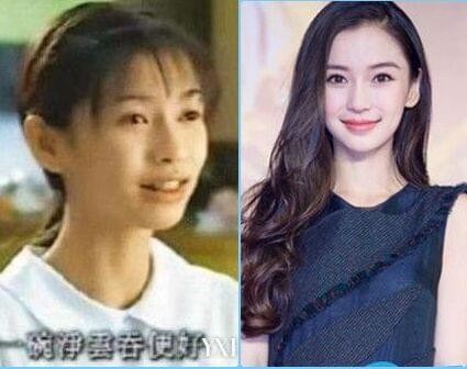 嫩模变脸杨颖：被整容史困住的盛世美颜还能撑多久？  第1张