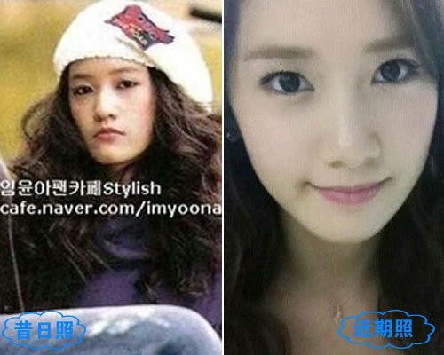 杨幂方脸回归，是岁月还是医美后遗症？  第2张